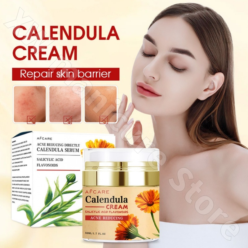 Luxury Skincare Whitening Cream - Repairing Calendula Cream Moisturizing and Rejuvenating