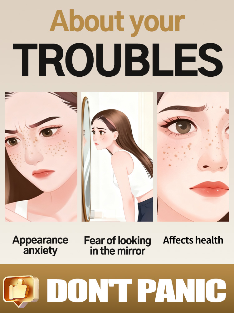 Lightening Facial Freckles Mel - đánh giá và giá Luxury Natural Skincare